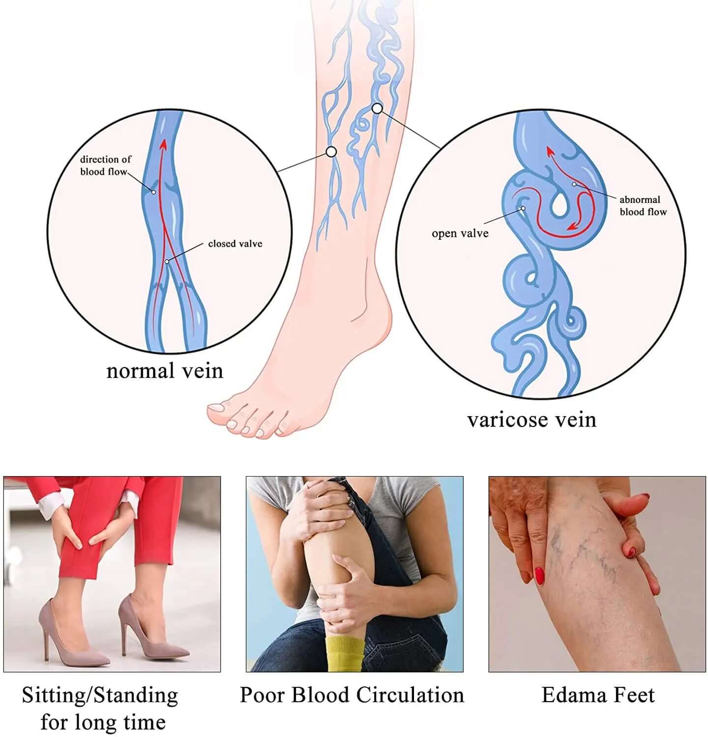 Medical Compression Pantyhose for Women - Viva Bella