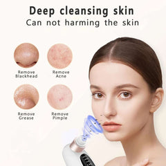 Electric Pimple Acne Black Head Remover - Viva Bella