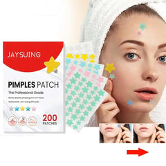 200pcs Star Acne Pimple Patches Colorful Breathable Removal Pimple Absorb Secretions Anti Infection Concealer Makeup Skin Care - Viva Bella