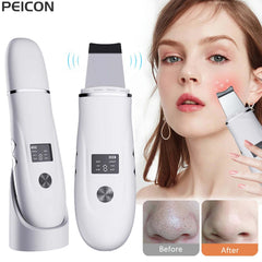 Ultrasonic Skin Scrubber Scrubber Deep Vibrate Facial Cleaner Shovel Face Scrubber Peeling Black Head Remover Facial Massager - Viva Bella