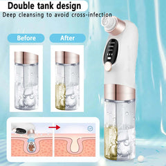 Electric Pimple Acne Black Head Remover - Viva Bella