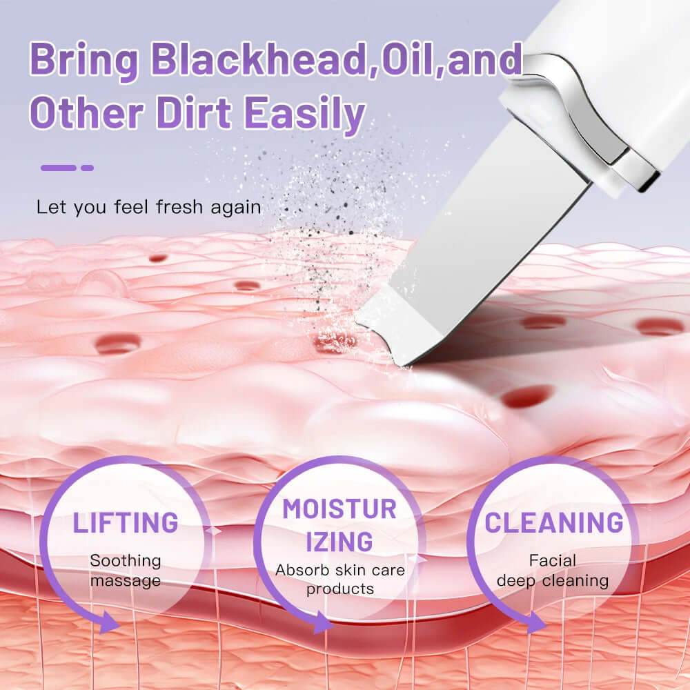 Facial Ultrasonic Skin Scrubber - Viva Bella