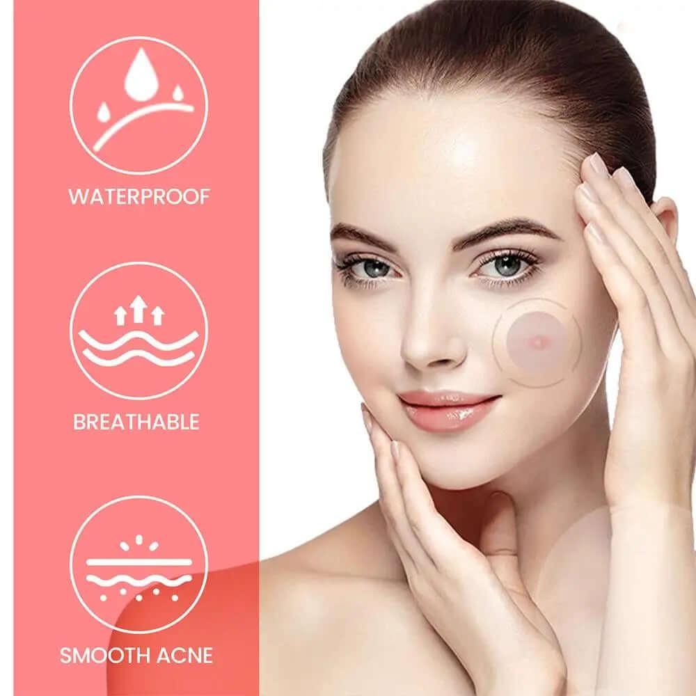 200pcs Star Acne Pimple Patches Colorful Breathable Removal Pimple Absorb Secretions Anti Infection Concealer Makeup Skin Care - Viva Bella
