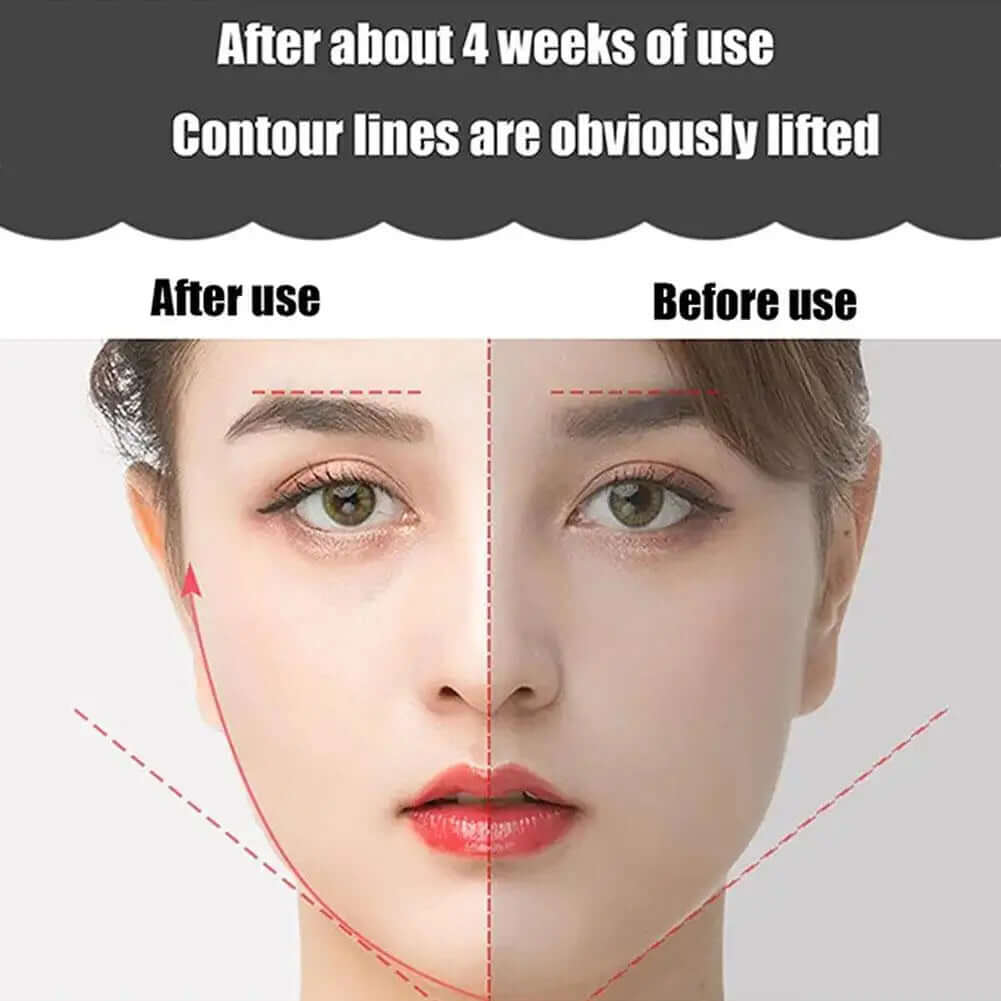 Face Lifting Roller Facial Massager Y Shape Lifting Facial Massager Chin Lift Up Home Use Beauty Instrument Skin Care Tool - Viva Bella