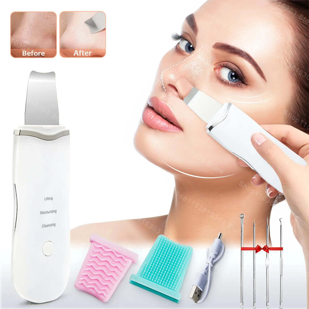 Facial Ultrasonic Skin Scrubber - Viva Bella