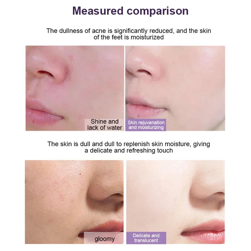 New Hot Green Tea Solid Cleansing Mask Dispel Acne Blemish Mark Remove Blackhead Acne Hydrating Moisturizing Deep Cleansing Mask - Viva Bella