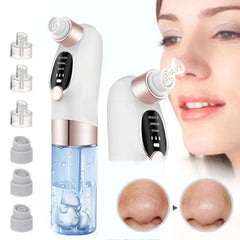 Electric Pimple Acne Black Head Remover - Viva Bella