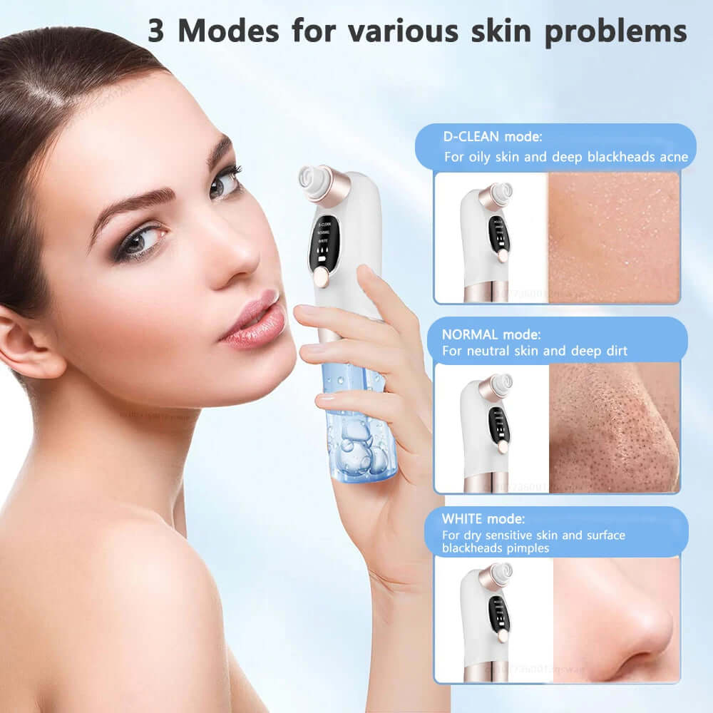 Electric Pimple Acne Black Head Remover - Viva Bella