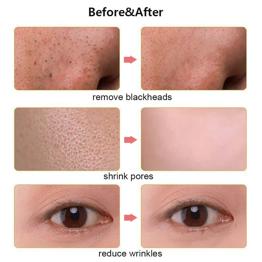 Ultrasonic Skin Scrubber Scrubber Deep Vibrate Facial Cleaner Shovel Face Scrubber Peeling Black Head Remover Facial Massager - Viva Bella