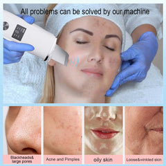 Ultrasonic Skin Scrubber Scrubber Deep Vibrate Facial Cleaner Shovel Face Scrubber Peeling Black Head Remover Facial Massager - Viva Bella