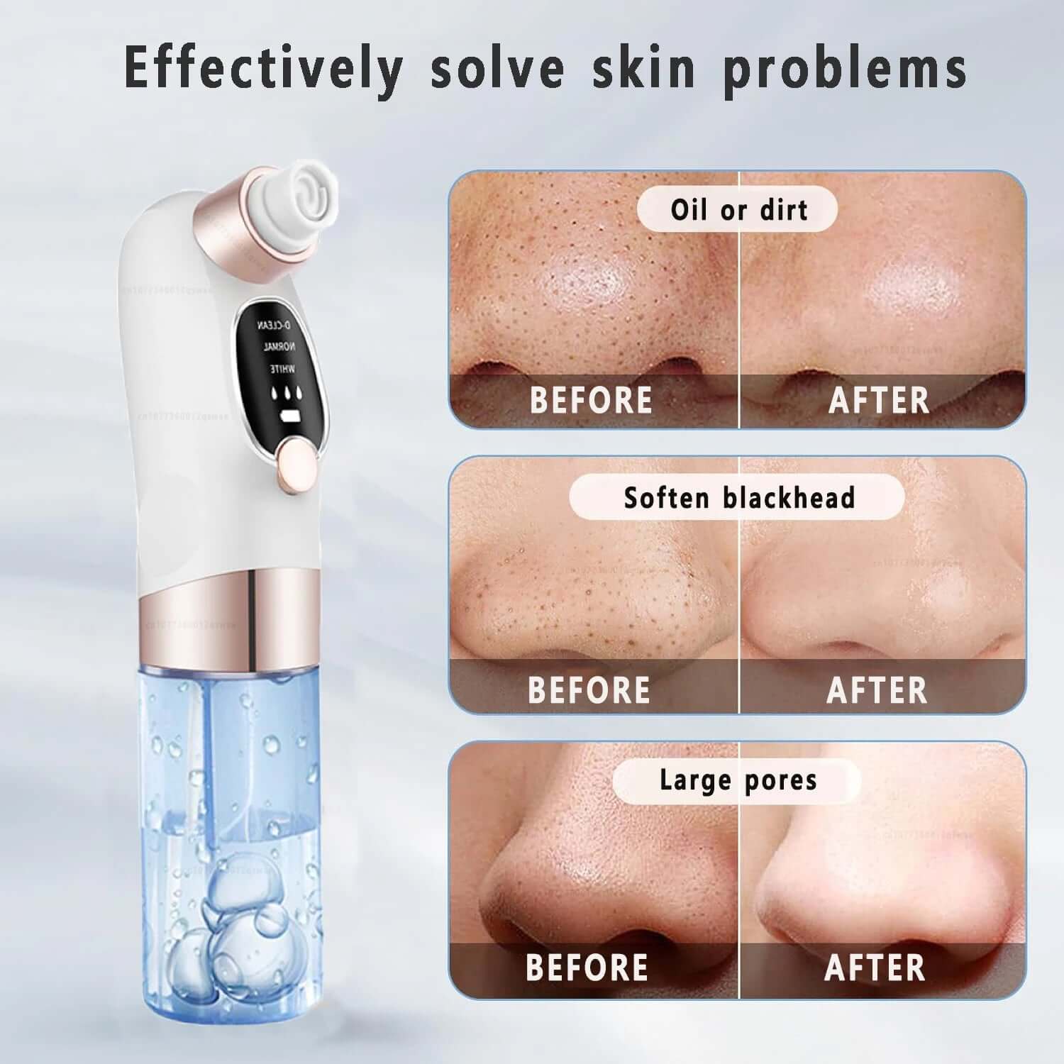 Electric Pimple Acne Black Head Remover - Viva Bella