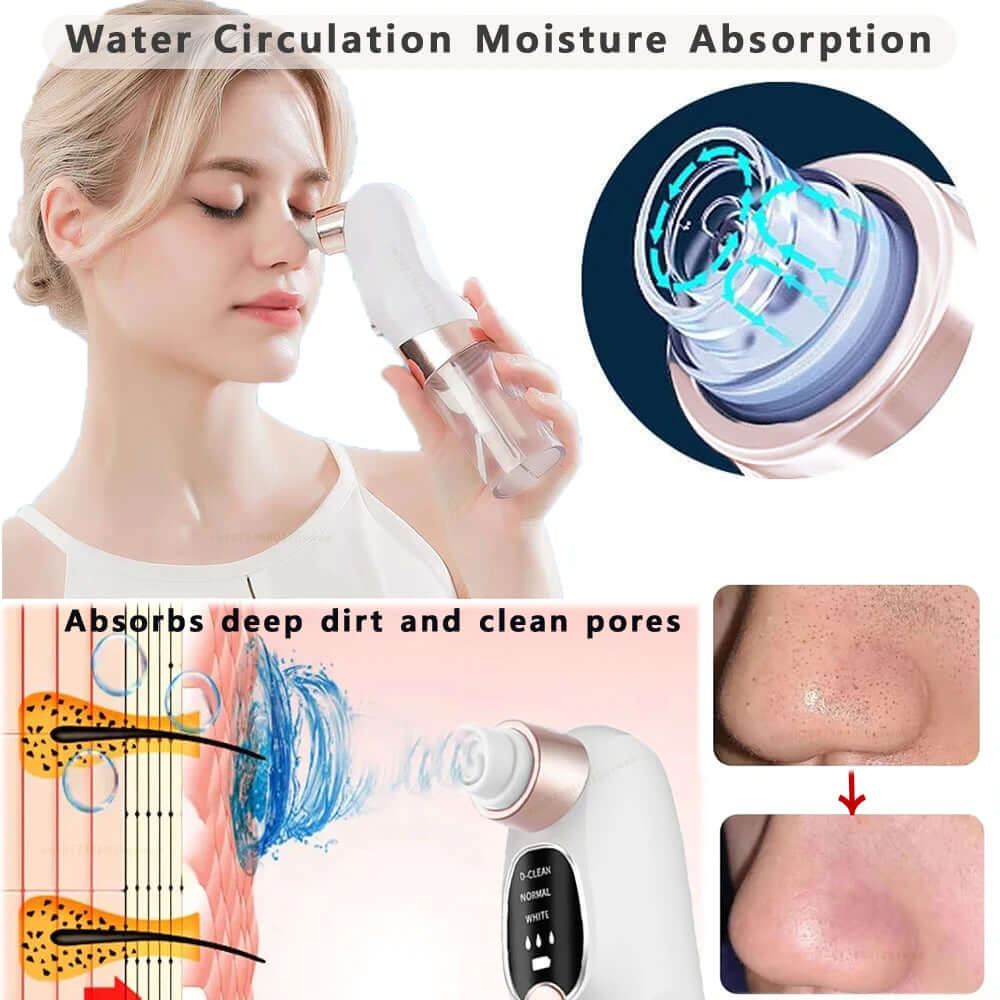 Electric Pimple Acne Black Head Remover - Viva Bella
