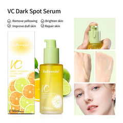 Vitamin C Brightening Serum – Dark Spot Corrector - Viva Bella