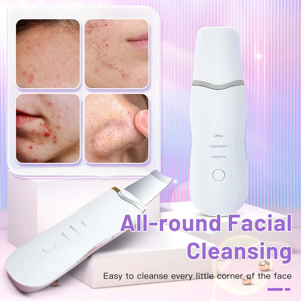 Facial Ultrasonic Skin Scrubber - Viva Bella